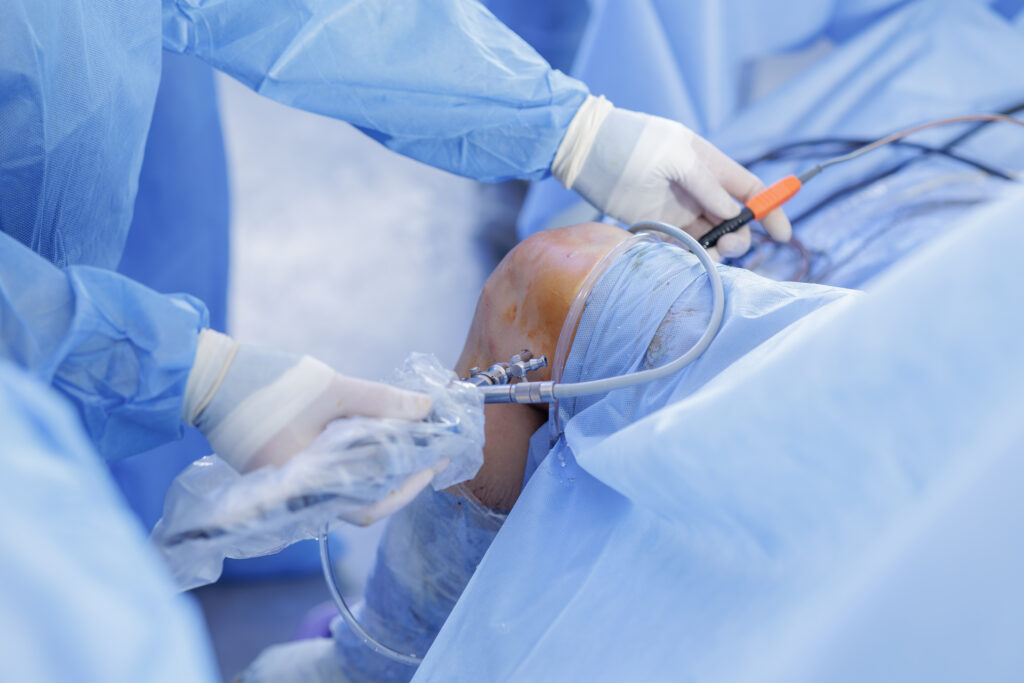 knee surgery